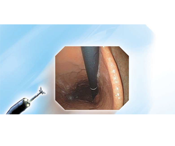 Gastroscope